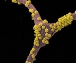 Genomics reveals distinct patterns of emergence of SARS‐CoV‐2 spike variants in Columbus, Ohio