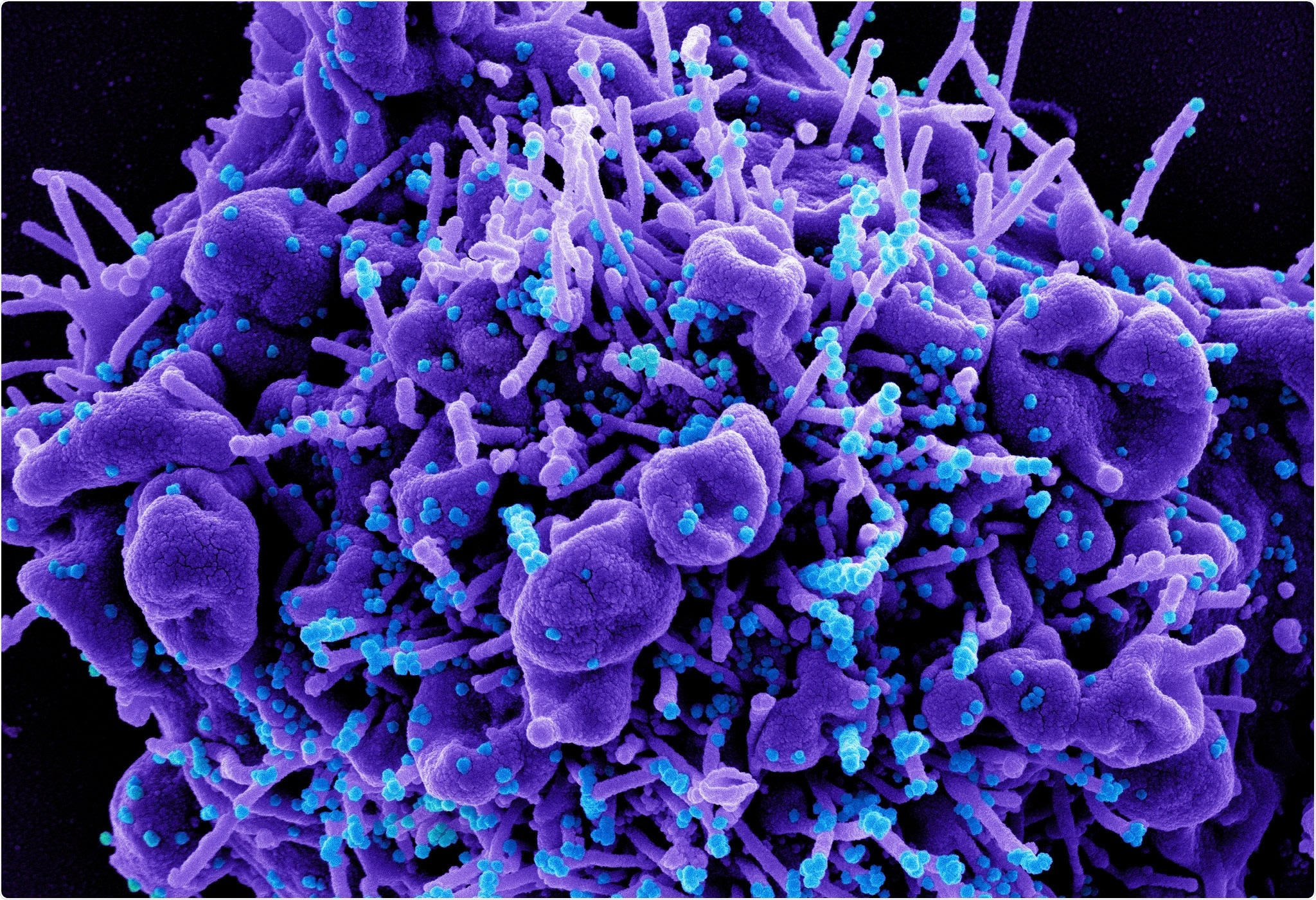 Study: Hidden Parameters Impacting Resurgence of SARS-CoV-2 Pandemic. Image Credit: NIAID