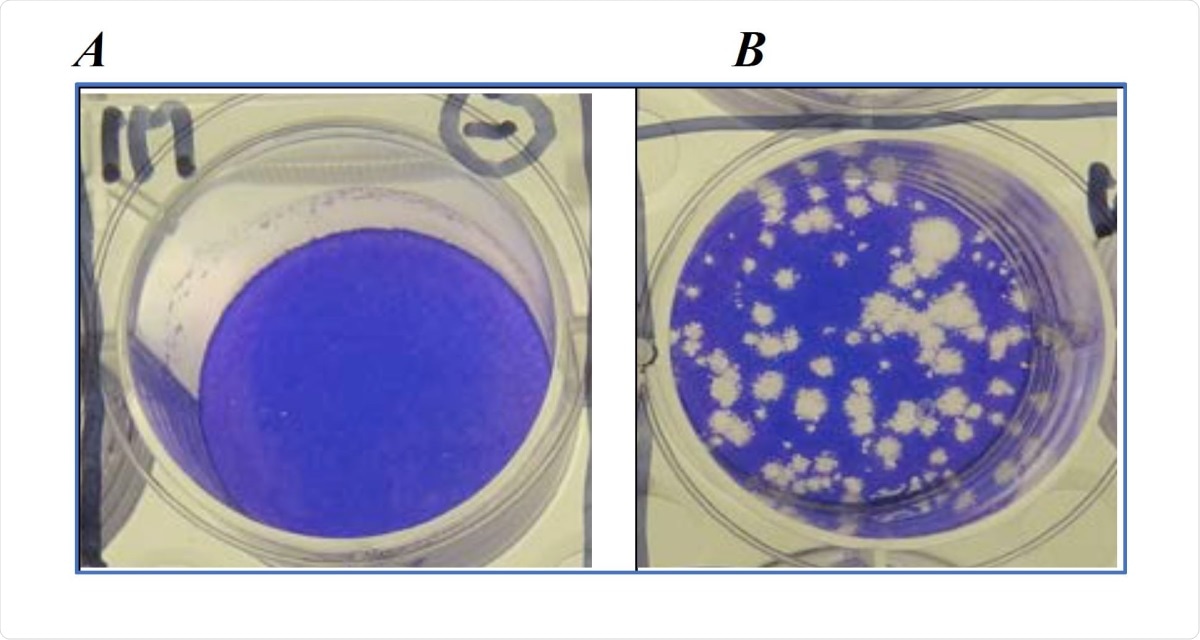 Plaque Assay with SARS-CoV-2. A) uninfected VERO-E6 cells grown to confluency and stained with crystal violet to show take up by viable cells. B) confluent VERO-E6 cells infected with SARS-CoV-2 and subsequently stained with crystal violet to show dead and dying cells seen as clear plaques.