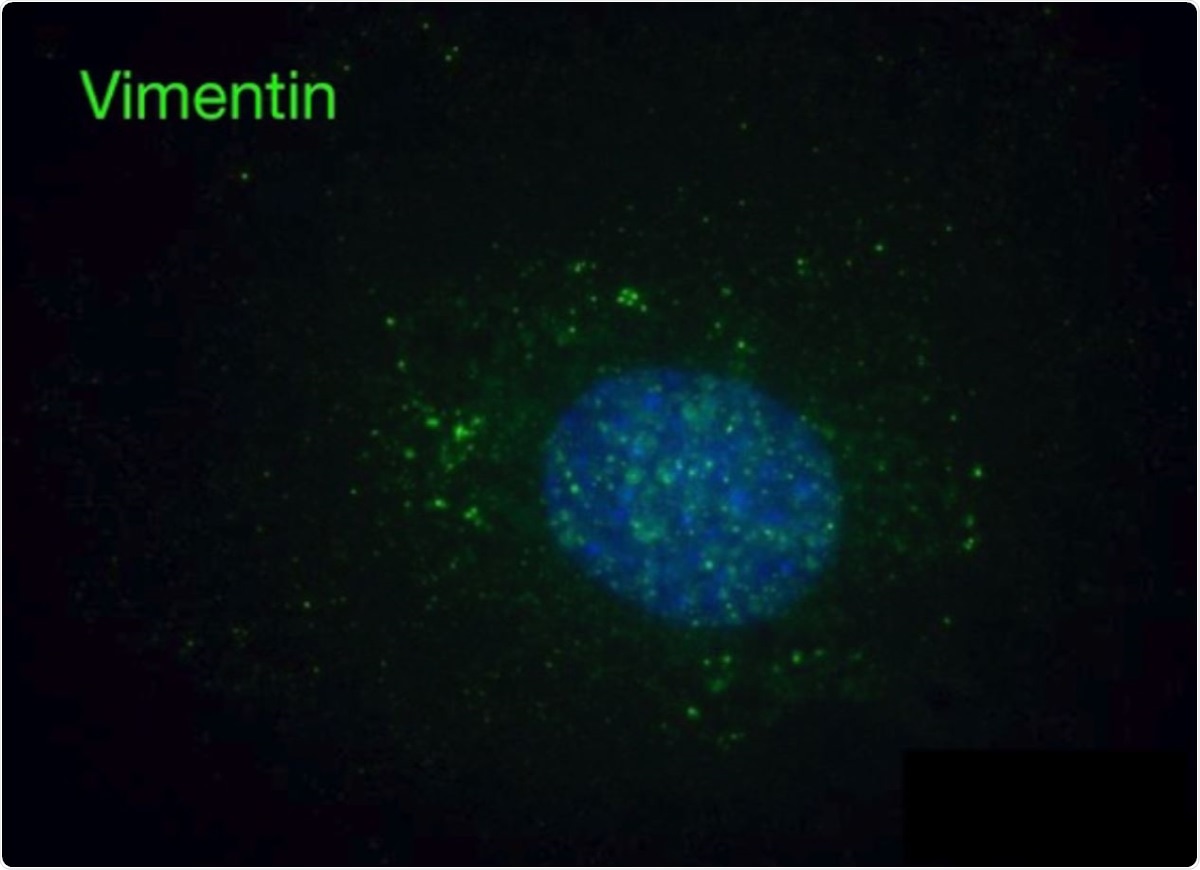 Immunofluorescence images of vimentin-null mEF staining positive for extracellular vimentin after exposure to supernatant of NETosis-activated neutrophils, indicating the acquisition of extracellular vimentin by cells that do not express vimentin.