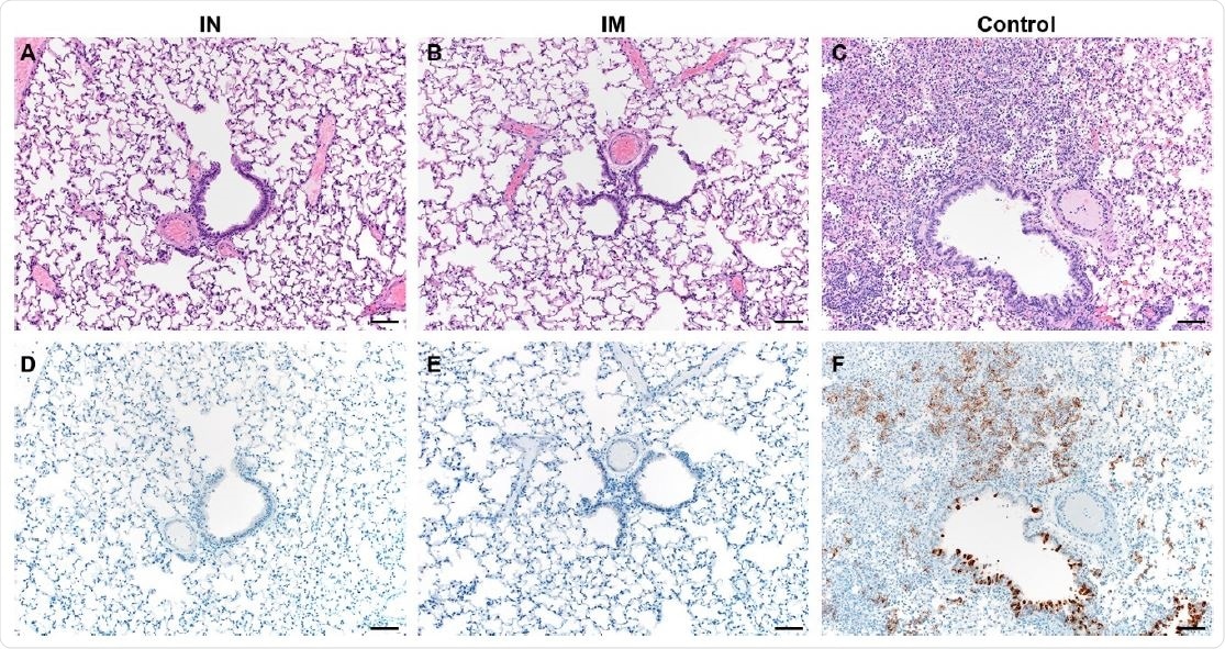 Pulmonary effects of direct intranasal challenge with SARS-CoV-2 in Syrian hamsters. A-C. H&E; D-F. IHC. A/B. No pathology. C. Moderate to marked interstitial pneumonia. D/E. No immunoreactivity. F. Numerous immunoreactive bronchiolar epithelial cells and Type I&II pneumocytes. Bar = 50μm.
