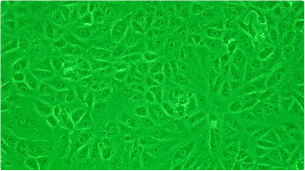 Estudio: Las células humanas de la aerovía previenen la adaptación multibasic del cultivo celular del sitio de la hendidura SARS-CoV-2. Haber de imagen: Tambe de Y - el propio trabajo, centímetro cúbico BY-SA 3,0.