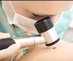 DermaSensors: The Future of Skin Cancer Detection