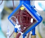 How is ECMO Being Used to Treat Severe COVID-19?