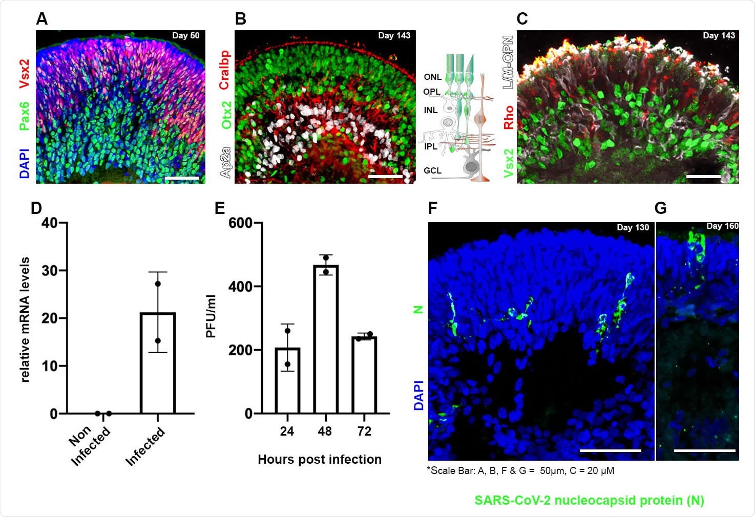 Human iPSC-derived retinal organoids can be infected by SARS-CoV-2 Retinal organoids on day 50 of differentiation are shown to contain VSX2+ (green) retinal progenitors and PAX6+ (white)/VSX2- amacrine and retinal ganglion cells (RGCs) (A). On day 143 of differentiation, the organoids are shown to be organized in a layered structure and to contain AP2a+ (white) amacrine and horizontal cells, CRALBP+ (red) Müller glia cells, and OTX2+ (green) cells (B). The sketch in (B) depicts the cell types and structure of the vertebrate retina. ONL: outer nuclear layer; OPL: outer plexiform layer; INL: inner nuclear layer; IPL: inner plexiform layer; GCL: ganglion cell layer. On day 143 of differentiation, the photoreceptors in the organoids are stained against the photosensitive proteins L/M-OPN (white) and RHODOPSIN (RHO, red) (C). Real-time PCR identified SARS-CoV-2 genomic RNA within retinal organoids treated with SARS-CoV-2 but not in controls on day 125 (D). A viral plaque assay was used to assess viral titrations in SARS-CoV-2 treated organoids on day 125 (E). Each repeat (N=2) in (D) and (E), is a separate group of five organoids infected or not infected in a separate well. Immunofluorescence analysis was used to detect SARSCoV-2 nucleocapsid (N)-positive cells in infected organoids at day 130 (F) or 160 (G) of differentiation.