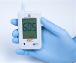 EKF Diagnostics to exhibit new STAT-Site WB β-ketone and glucose handheld analyzer at Medica 2021