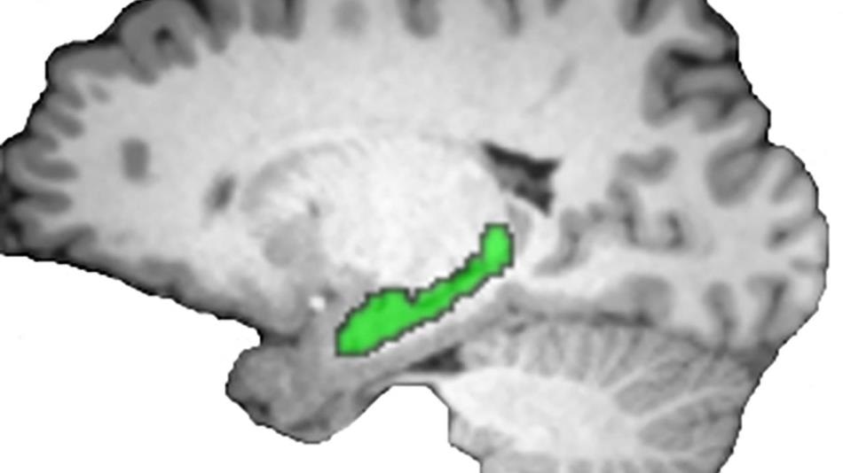 O hipocampo conecta eventos separados, distantes às memórias narrativas do formulário, mostras do estudo