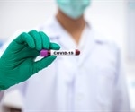 Biomarker predicts severity of SARS-CoV-2 infection in patients