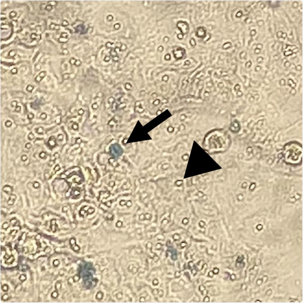 non-viable (arrow) and viable (arrowhead) Huh-7 cells treated with 20% Pacific oyster (Crassostrea gigas) hemolymph.
