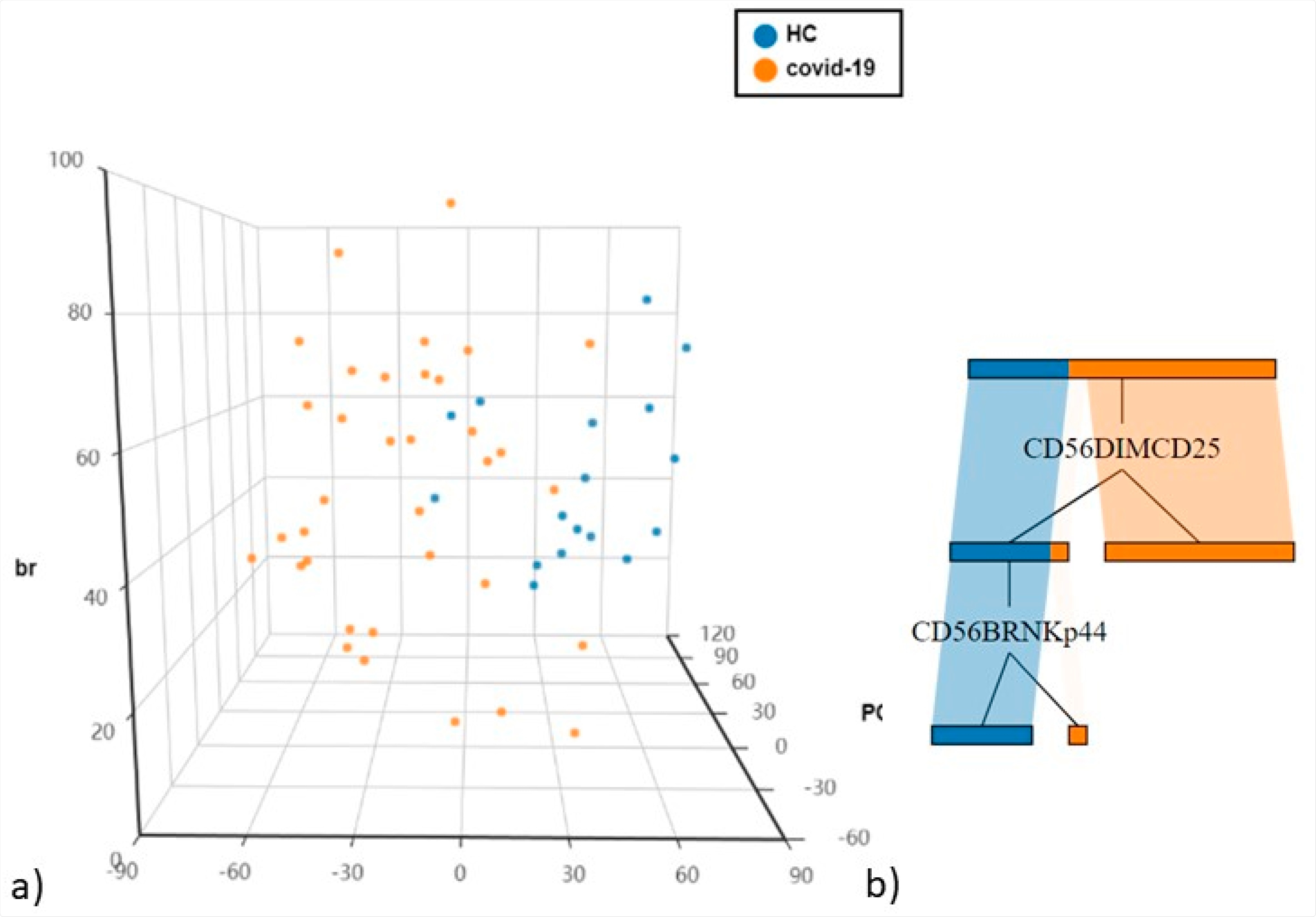(a) Principal Component Analysis (PCA) of NK cells and T cell subsets (b) The cellular subsets of patients were employed to create a decision tree model for the detection of best clustering variables between the two groups.