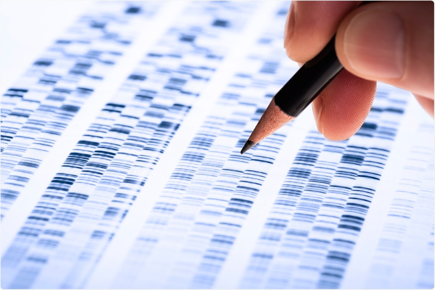Study: A combination of variant genotypes at two loci in the APOL1 gene is associated with adverse outcomes in SARS-CoV-2: a UK Biobank study. Image Credit: Gopixa / Shutterstock