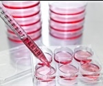 What is a Cell Proliferation Assay?