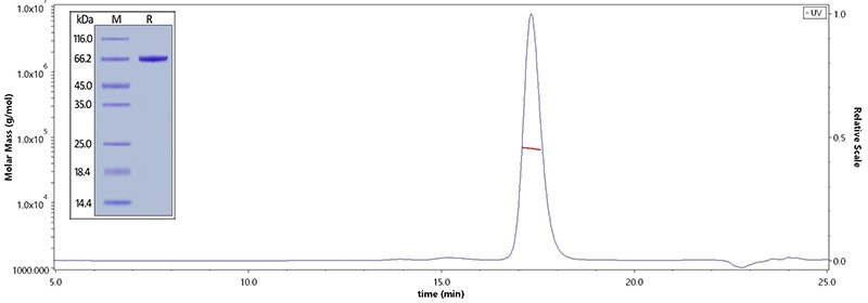 Human Serum Albumin, His Tag (Cat. No. HSA-H5220) on SDS-PAGE under reducing (R) condition. The purity of the protein is greater than 95%. The purity of Human Serum Albumin, His Tag (Cat. No. HSA-H5220) was more than 90% and the molecular weight of this protein is around 60–75 kDa verified by SEC-MALS.