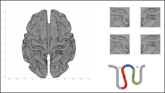 Study explores how the female brain responds to genital touch