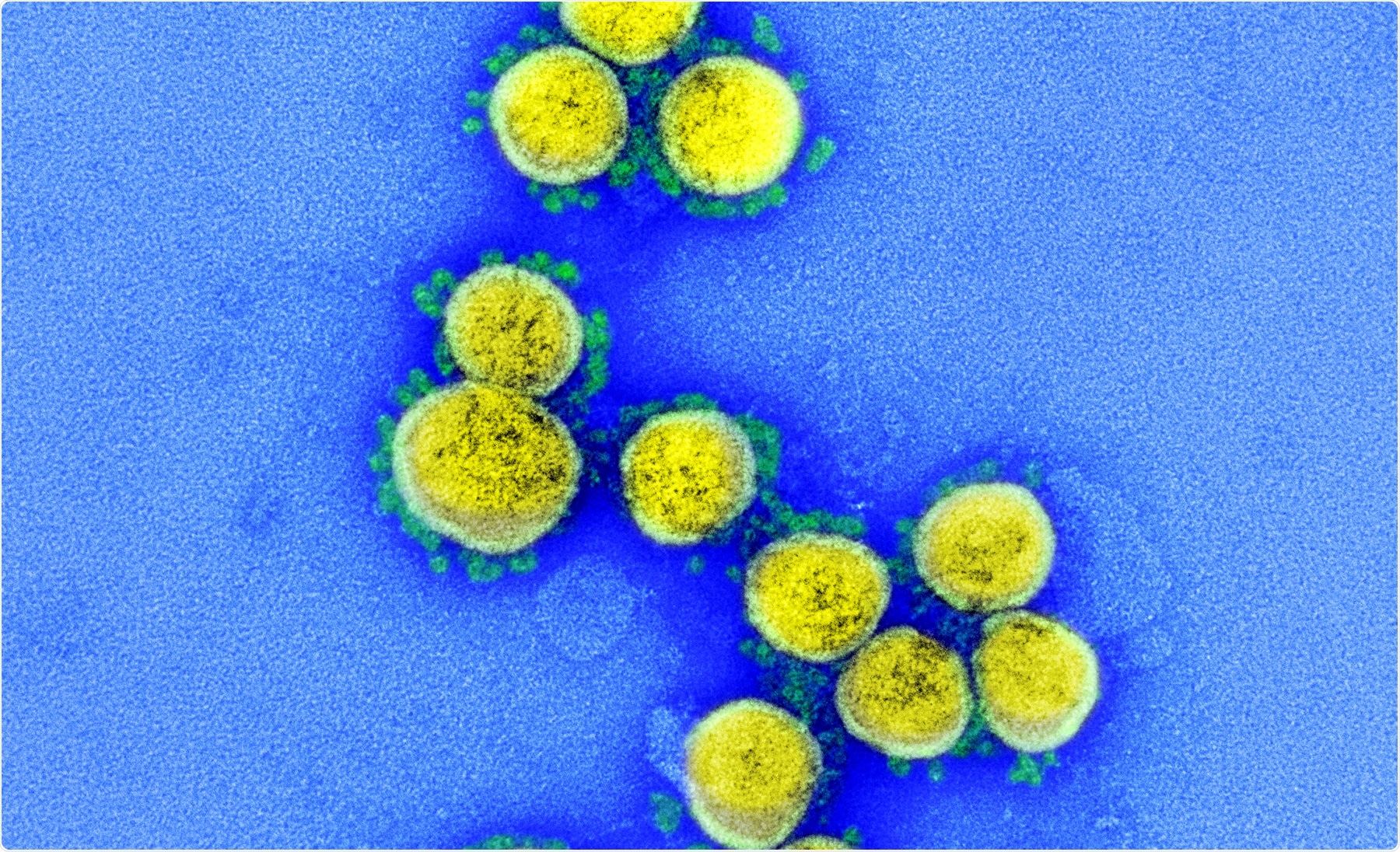 Study: Adjuvanting a subunit SARS-CoV-2 nanoparticle vaccine to induce protective immunity in non-human primates. Image Credit: NIAID