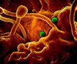 Stability and pathogenicity of MERS coronavirus varies across different viral strains
