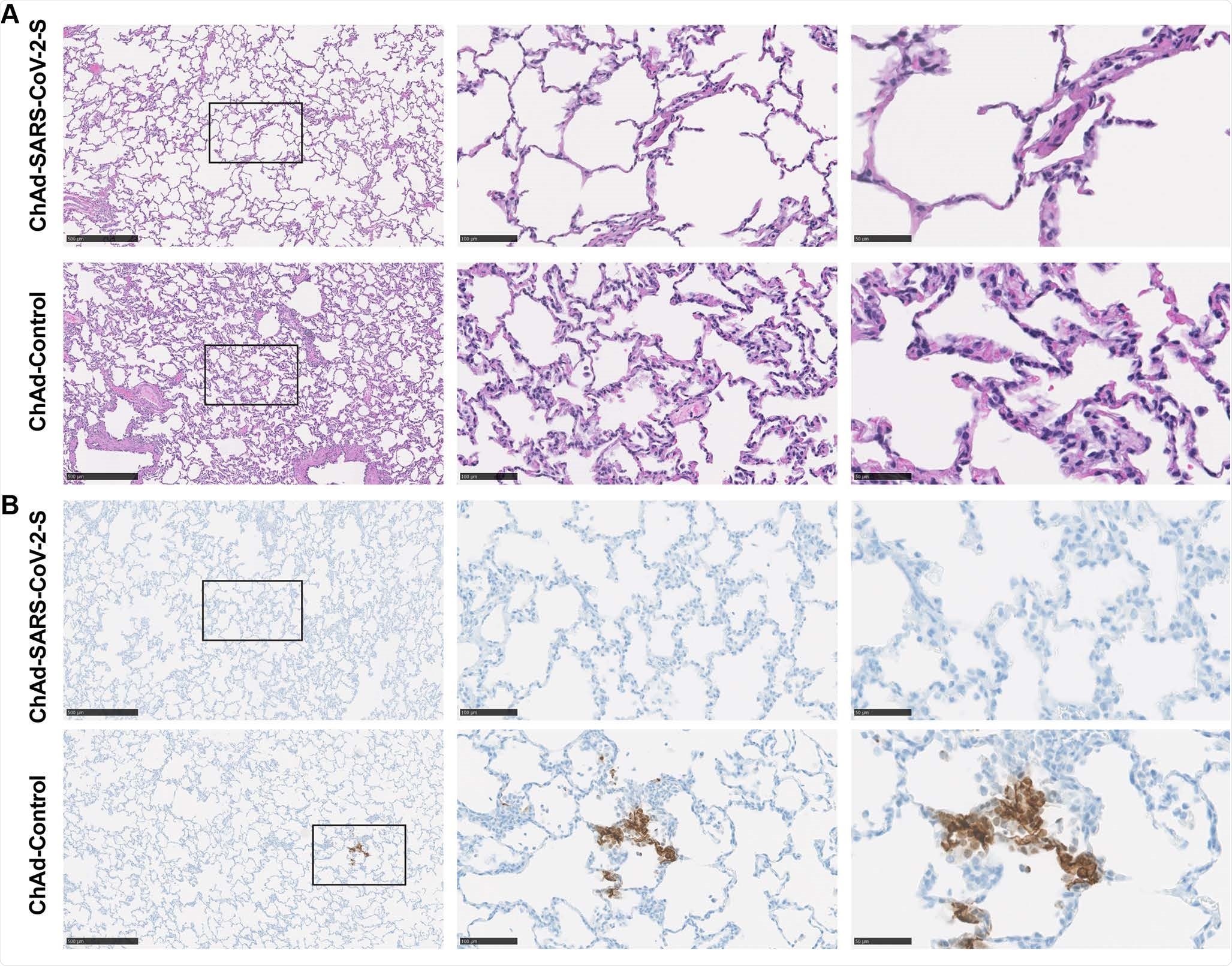 Pathological analysis of lungs of vaccinated RMs. RMs were immunized with ChAd-control and ChAd-SARS-CoV-2-S and challenged. Lungs were harvested at 7 dpi. A. Sections were stained with hematoxylin and eosin and imaged. Each image is representative of a group of 6 RMs. B. SARS-CoV-2 antigen was detected in lung sections from RMs for conditions described in (A). Images show low- (left; scale bars, 500 μm), medium- (middle; scale bars, 100 μm), and high-power magnification (right; scale bars, 50 μm). Representative images from n = 6 RMs per group.