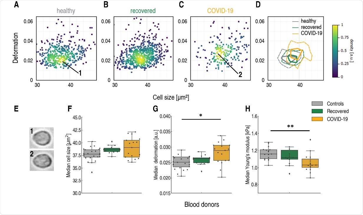 Lymphocytes are less stiff in peripheral blood of hospitalized COVID-19 patients. Typical scatter plot of lymphocyte deformation vs. cell size (cross-sectional area) of a a healthy blood donor with no known viral infection (A) compared to a patient four months after undergoing COVID-19 (B) and a patient with COVID-19 in an intensive care unit (C). (D) Kernel density estimate plots demonstrating the differences in cell size and deformation among the three donors (A-C). (E) No significant differences in lymphocyte cell size were found between healthy blood donors (grey, n = 24), recovered patients approximately five months after undergoing COVID-19 (green, n = 14), and patients hospitalized with COVID-19 (yellow, n = 17). (F) Lymphocytes exhibit significantly increased deformation in hospitalized COVID-19 patients. (G) Young’s modulus of lymphocytes is significantly higher in COVID-19 patients compared to the healthy or recovered donors. Statistical comparisons were done using Kruskal-Wallis test with Dunn’s posthoc test, * p < .05, ** p < .01, *** p < .001.