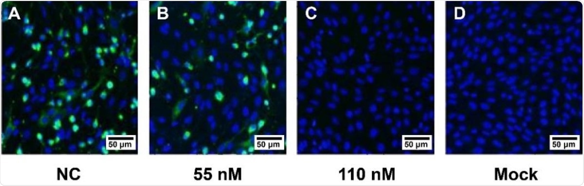 Vero E6 cells were incubated with the S-IgY for 2 h, followed by incubation with the secondary antibody (Alexa 488-labeled goat anti-mouse[1:500; Abcam]). The nuclei were stained with DAPI dye (Beyotime, China). The images were taken by fluorescence microscopy, Results were as follow: (A) NC:pre-immunized IgY: Full-field virus protein (B) SARS-CoV-2-IgY55nM:Viral protein decreased significantly in visual field,About 50% of the viruses were suppressed; (C) SARS-CoV-2-IgY110nM:Virus protein disappeared completely in visual field,The virus was completely suppressed; (D) Mock Cells without virus addition. It means that S-IgY can effectively inhibit the SARS-CoV-2 from entering cells and has a dose-dependent relationship.