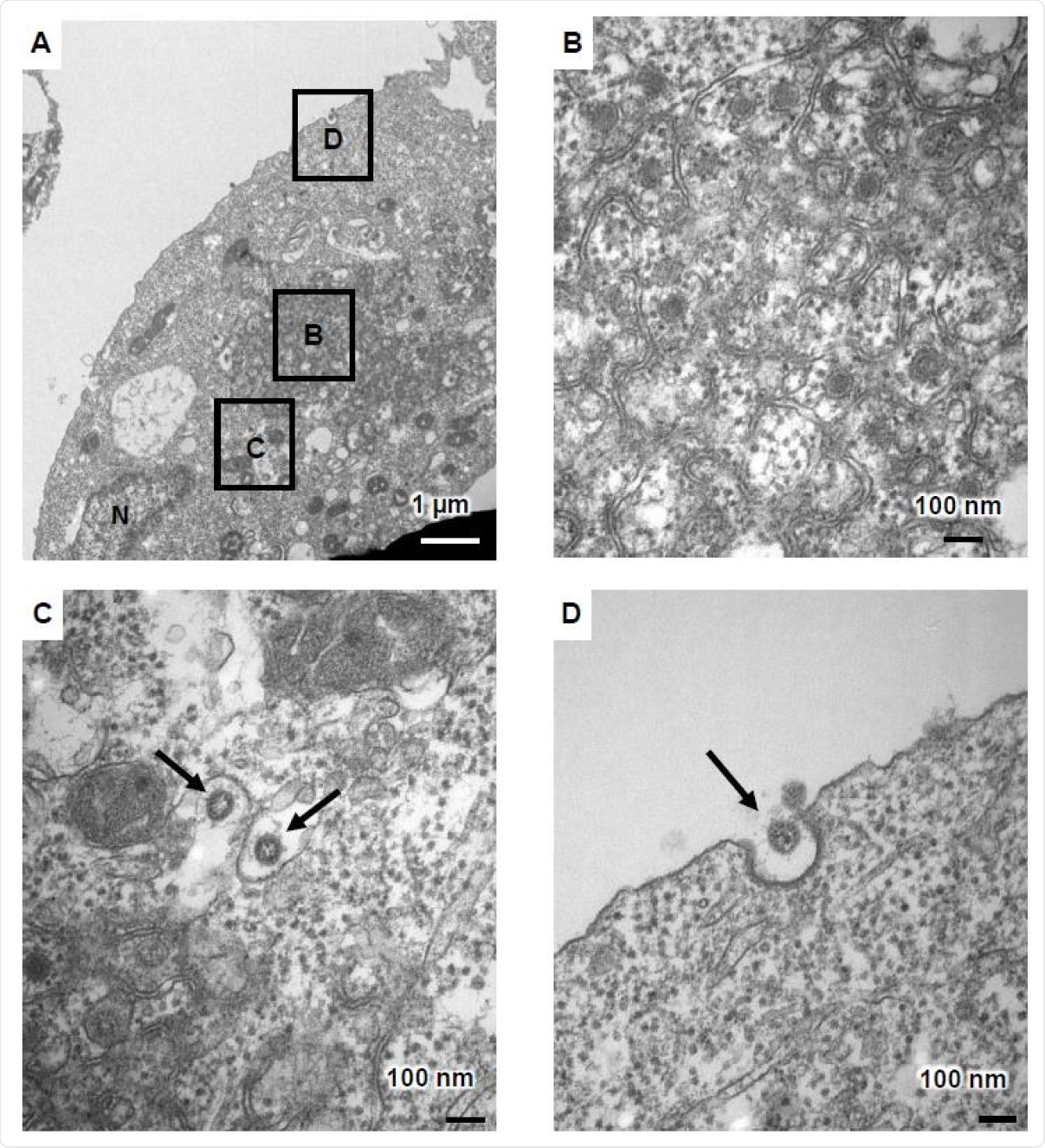 TEM images of infected ACE2-iPS cells (A) TEM images of infected ACE2-iPS cells. Zippered endoplasmic reticulum, double-membrane spherule (DMS) (B), and virus particles in the ERGIC (black arrows) (C) and near the cell membrane (black arrows) (D) were observed.