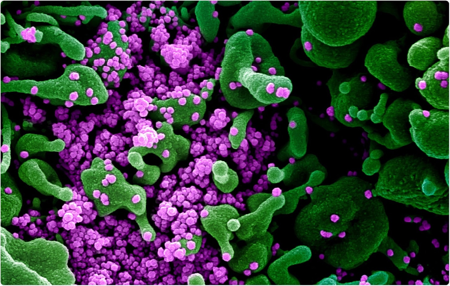 Estudo: In vitro neutralização poderoso de SARS-CoV-2 pela alpaca Hetero-bivalente Nanobodies que visa o domínio Receptor-Obrigatório do ponto. Crédito de imagem: NIAID