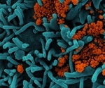 Study shows antibody responses persisting 10 months after SARS-CoV-2 infection