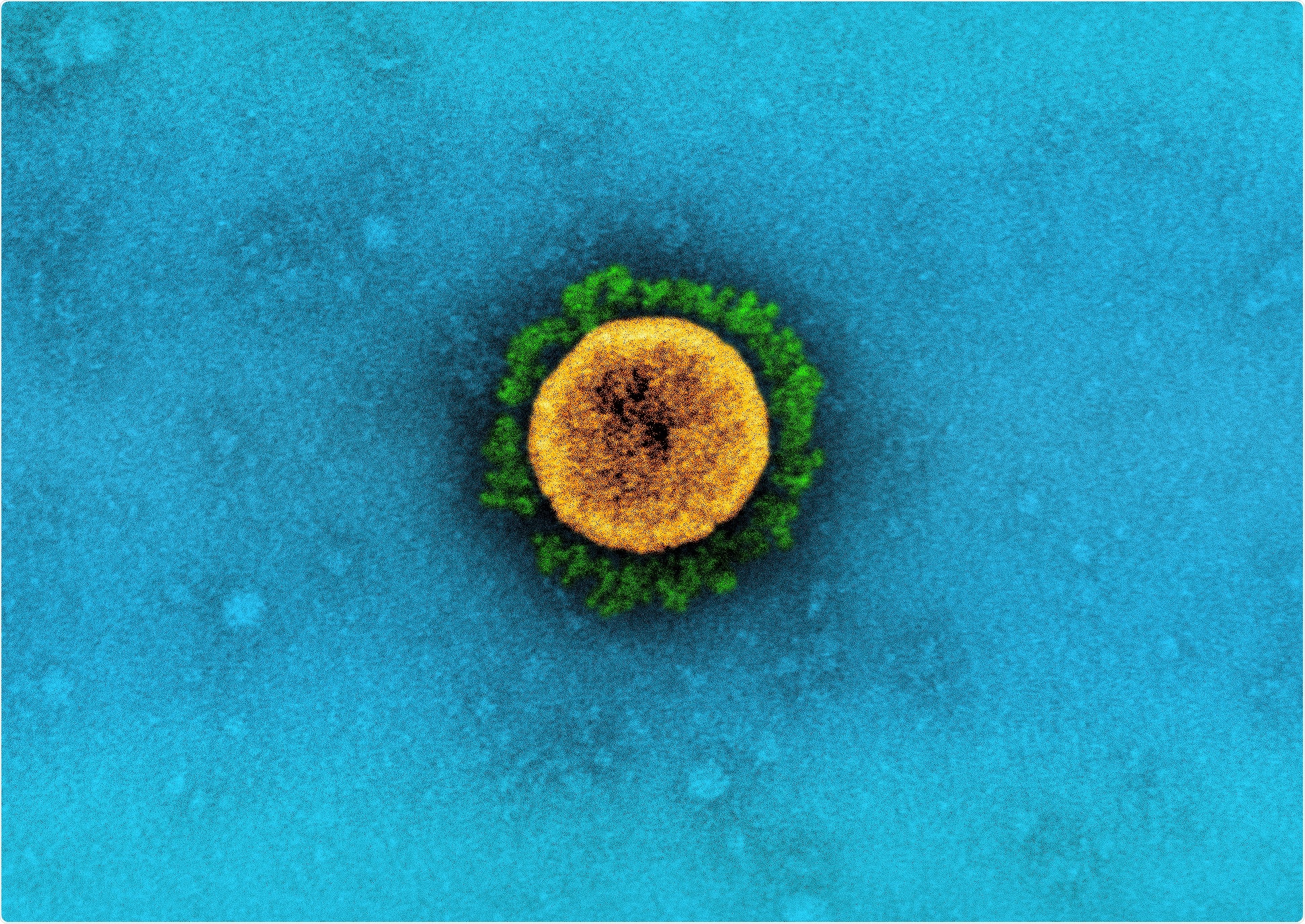 Study: A Novel SARS-CoV-2 Variant of Concern, B.1.526, Identified in New York. Image Credit: NIAID