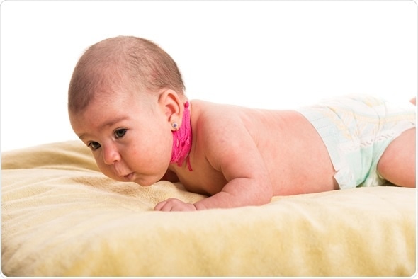 Newborn baby having torticollis neck waiting for massage - Image Copyright: Blaj Gabriel / Shutterstock