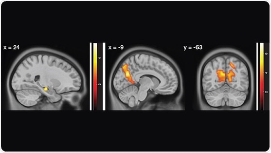 Overactive hippocampus may cause navigation impairments in aging adults