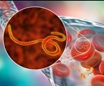 Ebola Virus Disease Diagnosis and Treatment