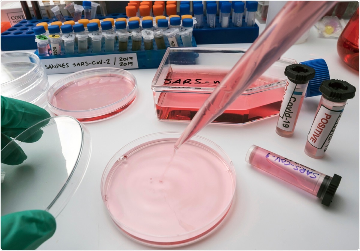Study: SARS-CoV-2 antigen rapid diagnostic test enhanced with silver amplification technology. Image Credit: Felipe Caparros / Shutterstock