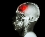What is Head Trauma?