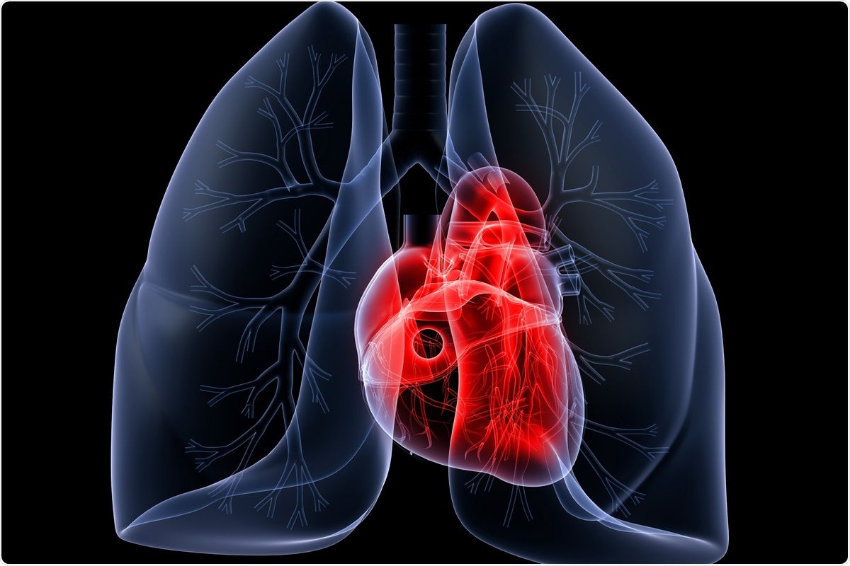 Study: Changes in the rate of cardiometabolic and pulmonary events during the COVID-19 pandemic. Image Credit: SciePro / Shutterstock