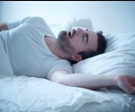 Obstructive Sleep Apnea Causes