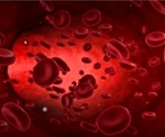 What are the changes in the physical phenotype of blood cells in COVID-19?