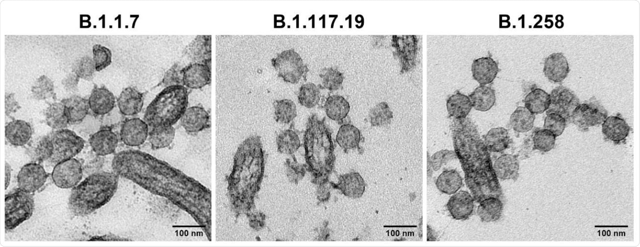 Comparative replication kinetics of SARS-CoV-2 lineage B.1.1.7 isolates in Vero and primary human airway epithelial (HAE) cells. TEM images of extracellular virions at the HAE apical cell surface at 72 hours post infection.