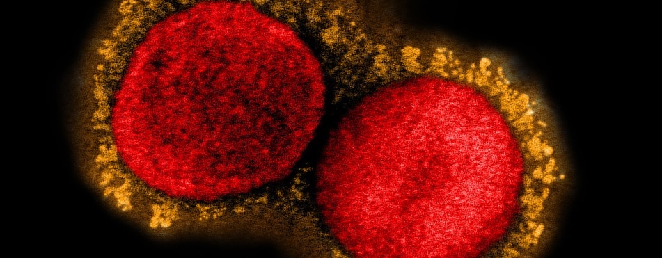 New coronavirus variant with E484K mutation detected in Arizona