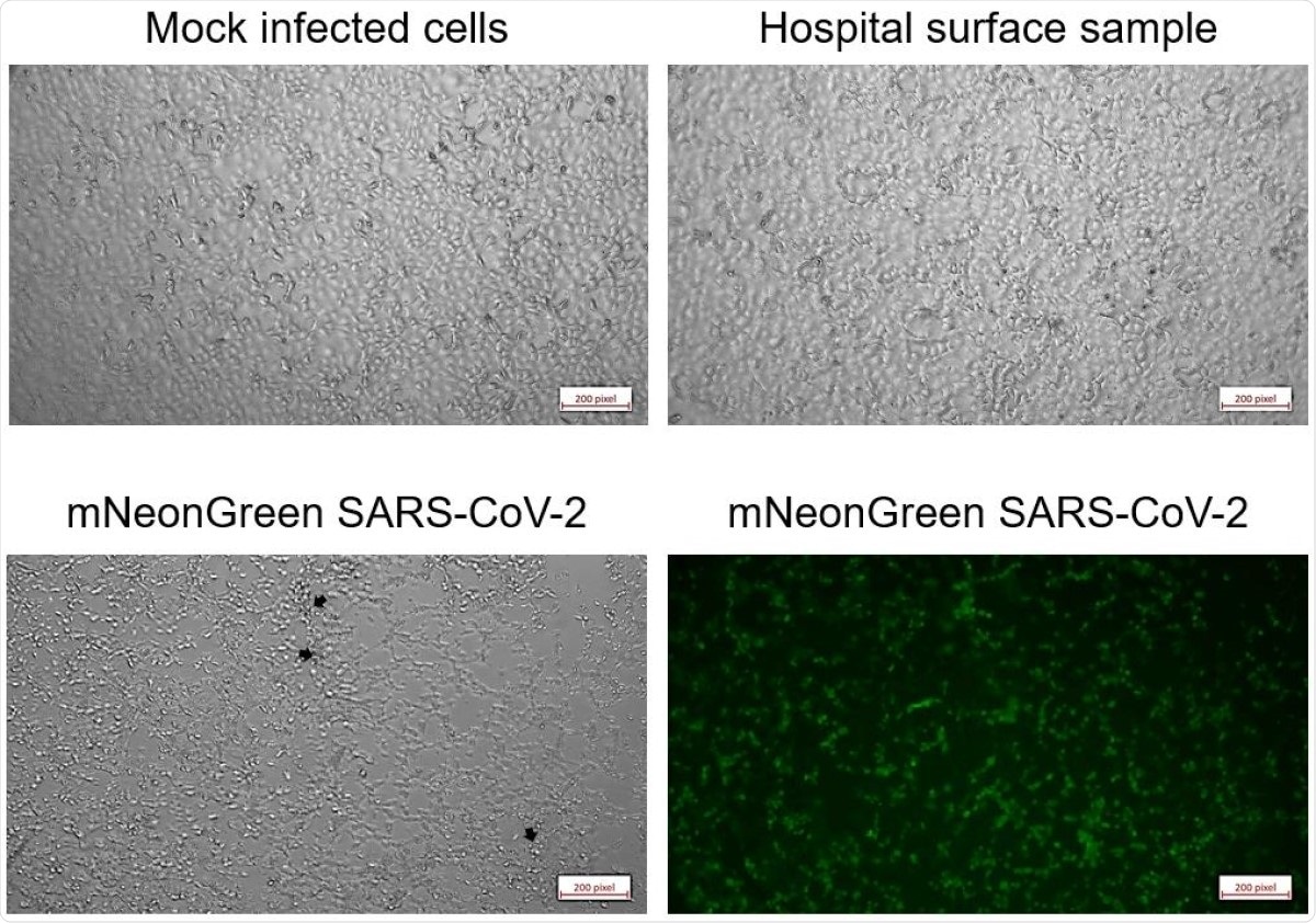 Micrographs of Vero E6 cells five days after inoculation. Cells were either mock-infected (upper left), inoculated with swab samples (representative of all five tested samples, upper right), or infected with one PFU of mNeonGreen SARS-CoV-2 (phase contrast, lower left; mNeonGreen lower right).
