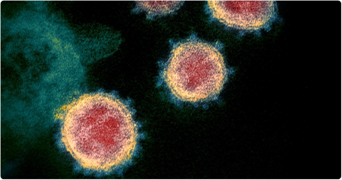 Study: Shed the light on virus: virucidal effects of 405 nm visible light on SARS-CoV-2 and influenza A virus. Image Credit: NIAID / Flickr