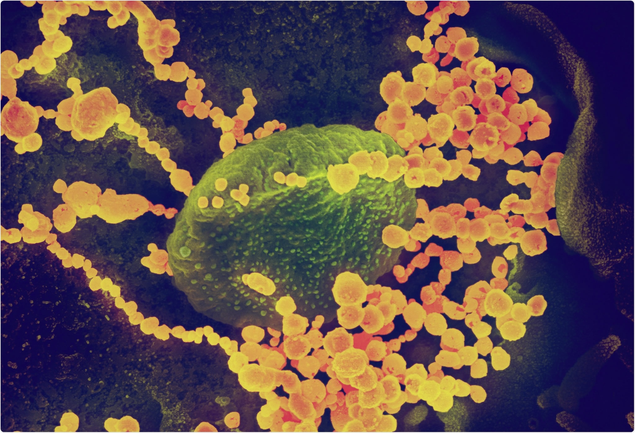 Study: Clofazimine broadly inhibits coronaviruses including SARS-CoV-2. Image Credit: NIAID