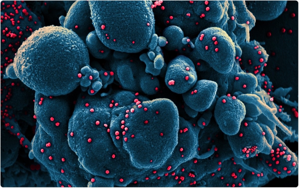 Colorized scanning electron micrograph of an apoptotic cell (blue) infected with SARS-COV-2 virus particles (red), isolated from a patient sample. Image captured at the NIAID Integrated Research Facility (IRF) in Fort Detrick, Maryland. Image Credit: NIAID / Flickr