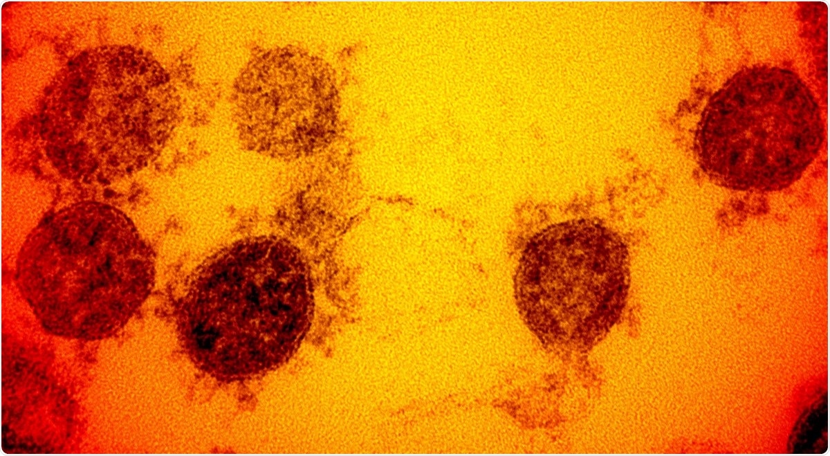 Study: High-content screening of coronavirus genes for innate immune suppression reveals enhanced potency of SARS-CoV-2 proteins. Image Credit: NIAID / Flickr