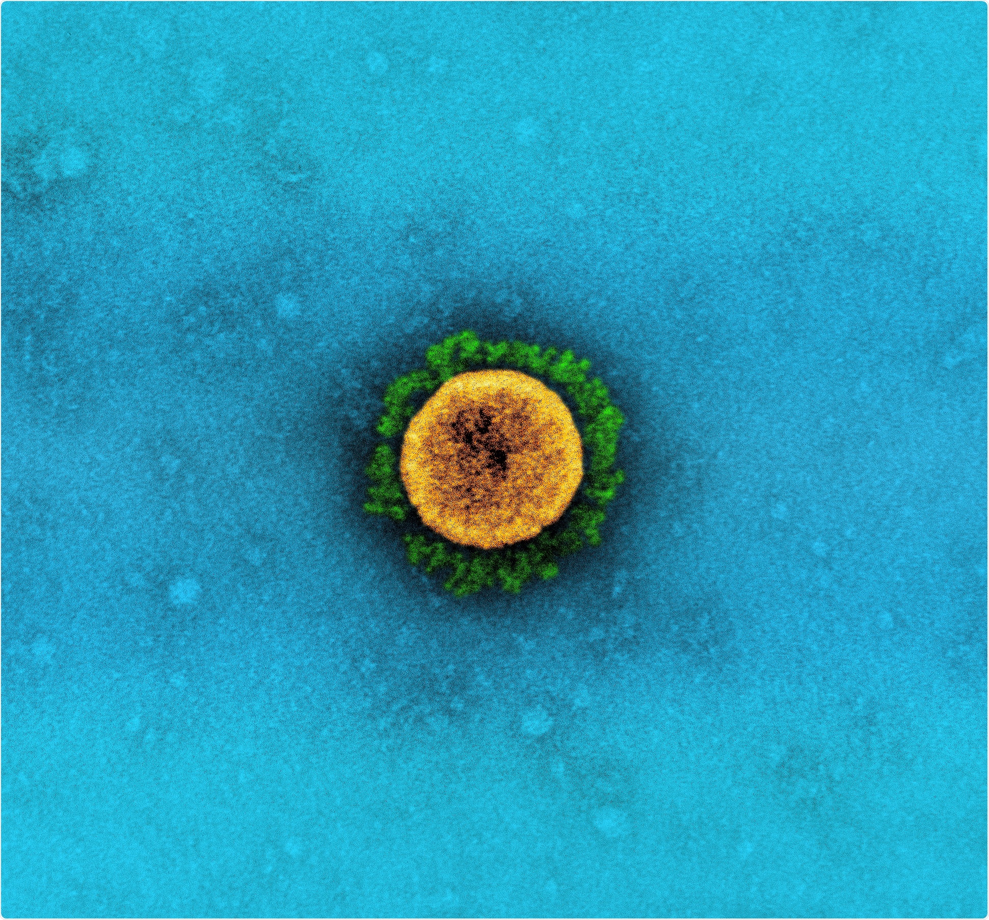 Study: SARS-CoV-2 hijacks folate and one-carbon metabolism for viral replication. Image Credit: NIAID