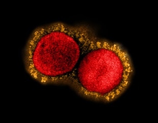 New coronavirus variant with E484K mutation detected in Arizona