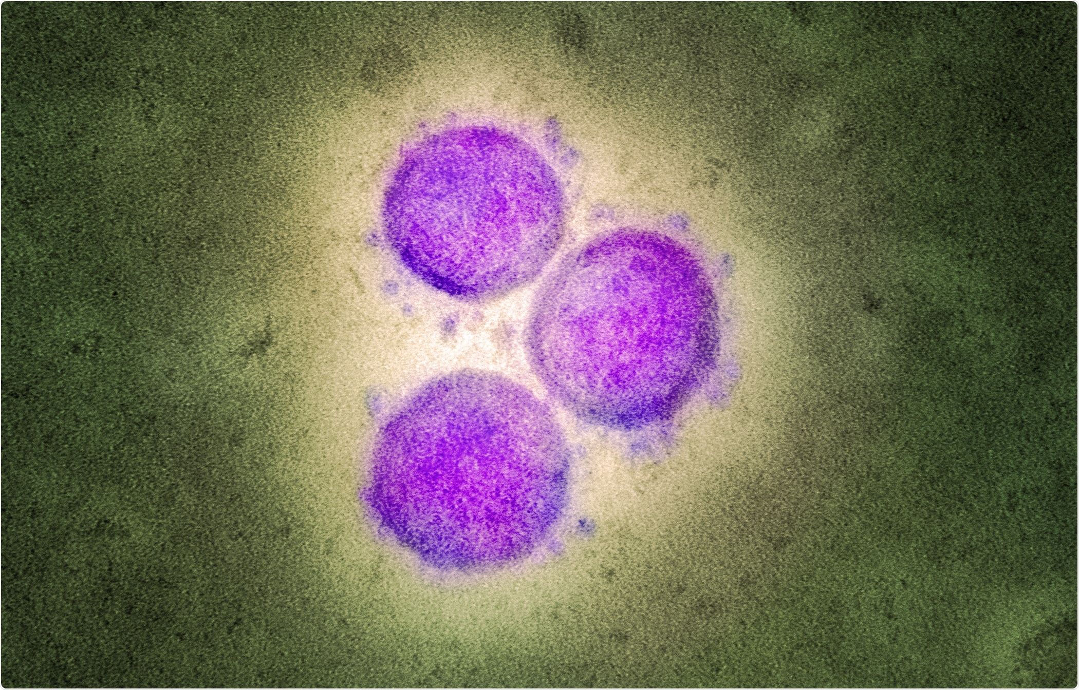 Transmission electron micrograph of SARS-CoV-2 virus particles (UK B.1.1.7 variant), isolated from a patient sample and cultivated in cell culture. Image captured at the NIAID Integrated Research Facility (IRF) in Fort Detrick, Maryland. Credit: NIAID