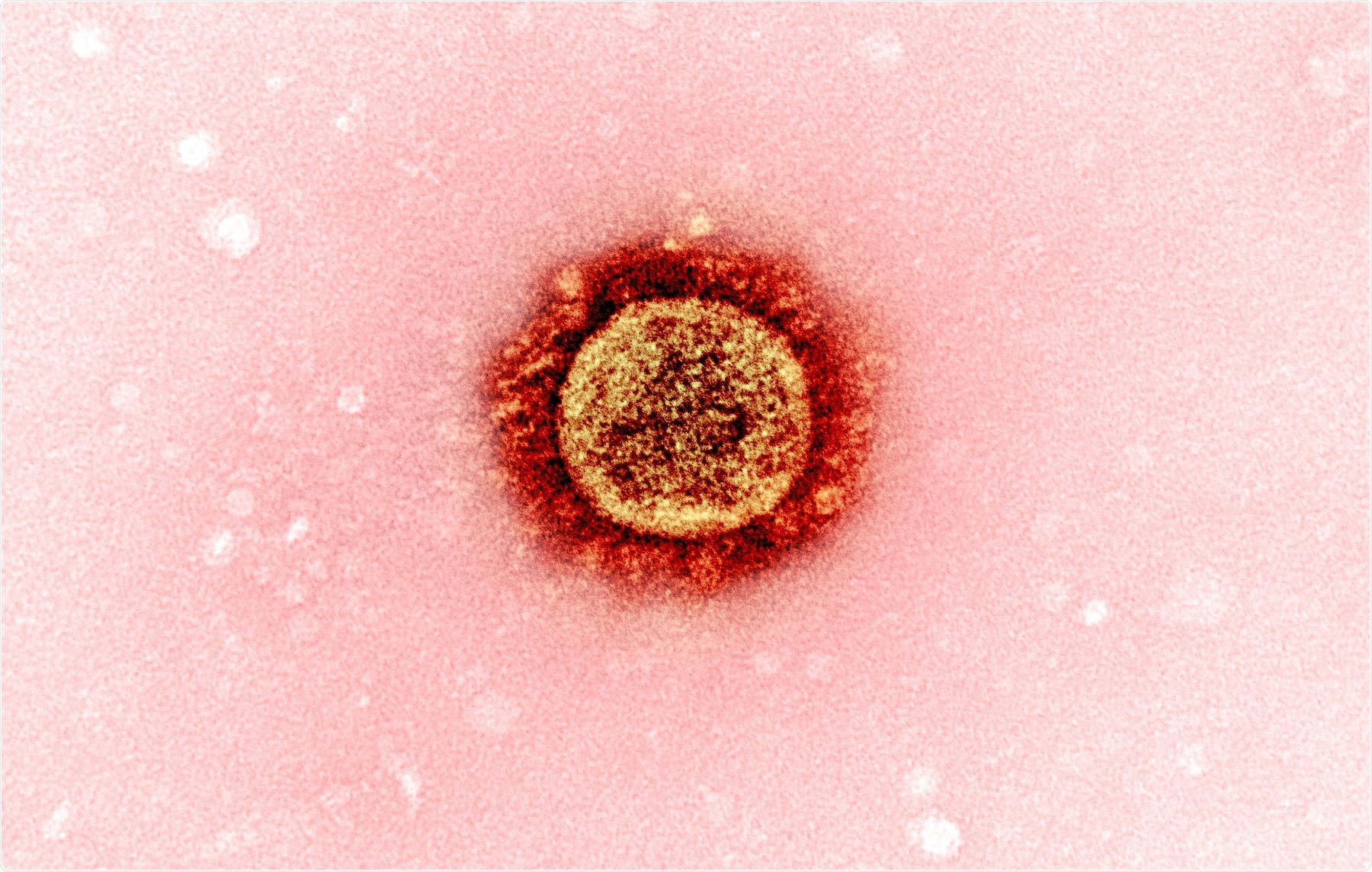 Study: A comparative recombination analysis of human coronaviruses and implications for the SARS-CoV-2 pandemic. Image Credit: NIAID