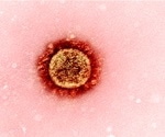 Preclinical study finds immune benefit in unrefrigerated Soligenix coronavirus vaccines
