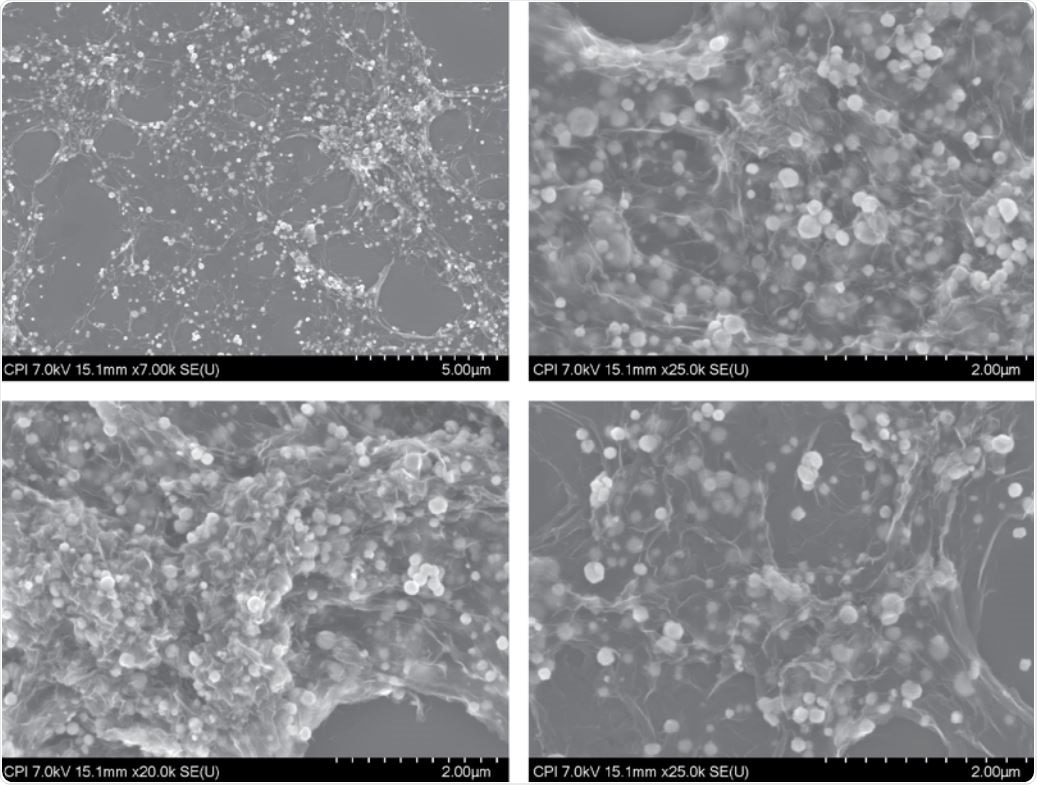 Generation of GO-AgNP by reduction of silver salt. (A) SEM micrographs of material R3 (60% Ag). (B) Ag particle size distribution of materials R1 (20%), R2 (40%), and R3 (60%).