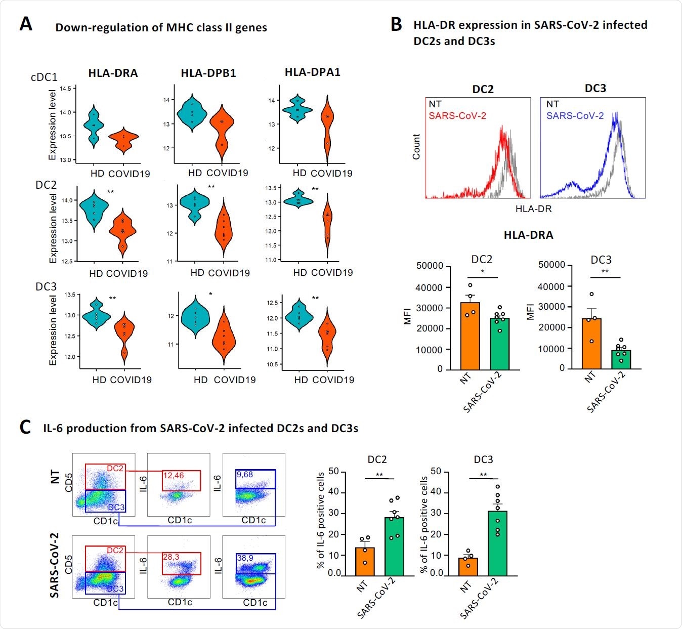 SARS-CoV-2 directly induces down-regulation of HLA-DR and production of IL- 6 in DC2s and DC3s. (A) Violin plots showing the expression levels of HLA-DRA, HLA-DPB1 and HLA-DPA1 in cDC1s, DC2s and DC3s of healthy controls and COVID-19 patients from dataset 1. Healthy samples are colored in blue and COVID-19 patients in red. *p < 0.05, **p < 0.01, Wilcoxon signed-rank test. (B, upper panel) Representative histograms showing HLA-DR expression in cDC2s from HDs infected or not (NT) with 0.4 MOI of SARS-CoV-2 for 18 hours. DC2s and DC3s were identified as CD5+ CD1c+ and CD5- CD1c+ respectively over the CD11+LIN- (CD88, CD89, CD3 and CD19) and FceRIa+. (B lower panel) Quantitative analysis of mean fluorescent intensity (MFI) of HLA-DR in DC2s and DC3s. Statistical significance was determined with unpaired student’s t-test. *p < 0.005,