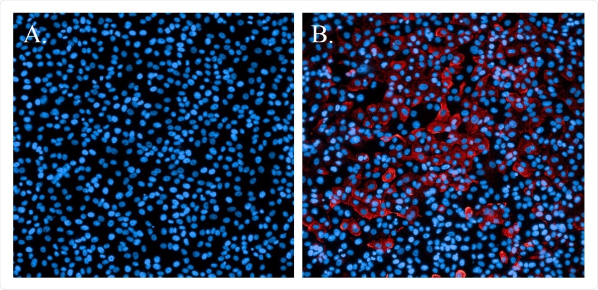 Immunofluorescence staining of SARS-CoV-2-infected cells. A. Non-infected cells stained with Hoechst nuclear stain (blue). B. Cells infected with SARS-CoV-2 and probed with a SARS-CoV N-protein-specific antibody and Alexa594 secondary antibody (red). Cells were counterstained with Hoechst nuclear stain (blue).